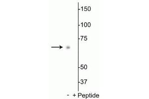 Western blot of Drosophila S2 cell lysate showing specific labeling of the ~70 kDa p70 S6K protein phosphorylated at Thr398 in the first lane (-). (RPS6KB1 anticorps  (pThr398))
