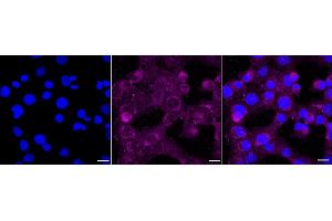 Immunocytochemical staining of HT- cells with MARK2 antibody (ABIN7799333), 1:1,000).