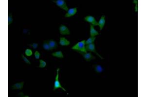 Immunofluorescence staining of HepG2 Cells with ABIN7127627 at 1:50, counter-stained with DAPI. (Recombinant Monoamine Oxidase A anticorps)