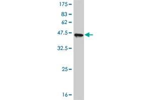 Western Blot detection against Immunogen (41. (ASK1 anticorps  (AA 1231-1374))