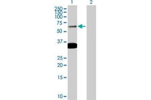 Western Blot analysis of SMAD6 expression in transfected 293T cell line by SMAD6 MaxPab polyclonal antibody. (SMAD6 anticorps  (AA 1-496))