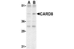 Western blot analysis of CARD8 expression in K562 cell lysate with AP30184PU-N CARD8 antibody at (A) 2 and (B) 4 μg /ml. (CARD8 anticorps)