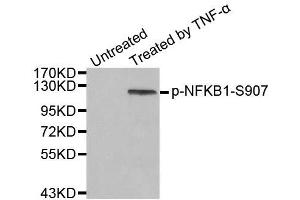 Western blot analysis of extract from HeLa cells, using phospho-NFKB1-S907 antibody (ABIN2988208). (NFKB1 anticorps  (pSer907))