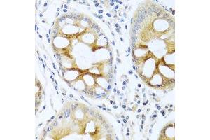 Immunohistochemistry of paraffin-embedded human colon using PRKCA antibody. (PKC alpha anticorps  (C-Term))