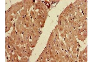 Immunohistochemistry of paraffin-embedded human heart tissue using ABIN7152606 at dilution of 1:100 (FADS1 anticorps  (AA 1-121))
