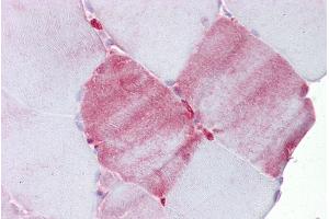 Immunohistochemistry with Skeletal muscle tissue at an antibody concentration of 5µg/ml using anti-FABP3 antibody (ARP47483_P050)