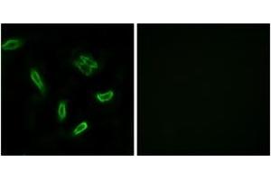Immunofluorescence (IF) image for anti-Solute Carrier Family 27 (Fatty Acid Transporter), Member 5 (SLC27A5) (AA 481-530) antibody (ABIN2890164) (SLC27A5 anticorps  (AA 481-530))