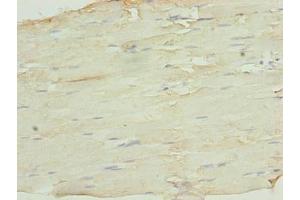 Immunohistochemistry of paraffin-embedded human skeletal muscle tissue using ABIN7169483 at dilution of 1:100
