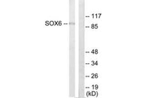 Western blot analysis of extracts from Jurkat cells, using SOX6 Antibody. (SOX6 anticorps  (AA 10-59))