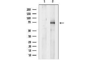 Western blot analysis of lysates from UV treated NIH-3 cells, using Phospho-Ezrin (Tyr353) Antibody.