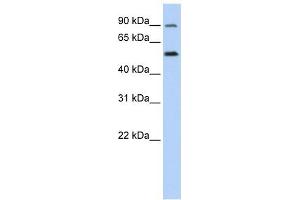 SLC41A1 antibody used at 1 ug/ml to detect target protein. (SLC41A1 anticorps  (N-Term))
