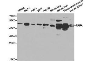 Western Blotting (WB) image for anti-Retinoic Acid Receptor, alpha (RARA) antibody (ABIN1875395) (Retinoic Acid Receptor alpha anticorps)