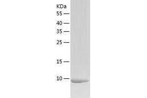 Western Blotting (WB) image for Calcium/calmodulin-Dependent Protein Kinase II Inhibitor 1 (CAMK2N1) (AA 1-78) protein (His-IF2DI Tag) (ABIN7122093)