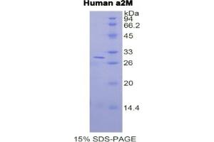 SDS-PAGE (SDS) image for alpha-2-Macroglobulin (A2M) ELISA Kit (ABIN6574110)
