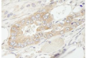 Immunohistochemistry (IHC) image for anti-Eukaryotic Translation Elongation Factor 1 gamma (EEF1G) (AA 200-250) antibody (ABIN7448955) (EEF1G anticorps  (AA 200-250))