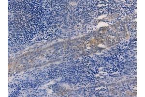 ABIN6256169 and ABIN6267274 at 1/100 staining human normal tonsil tissue by IHC-P. (Estrogen Receptor alpha anticorps  (pSer167))