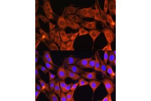 Immunofluorescence analysis of NIH/3T3 cells using  Rabbit pAb (ABIN1678678, ABIN3017841, ABIN3017842 and ABIN6220287) at dilution of 1:100.