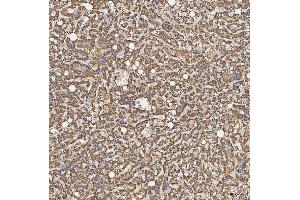 IHC analysis of SFXN5 using anti-SFXN5 antibody (ABIN7601388). (Sideroflexin 5 anticorps  (AA 34-340))