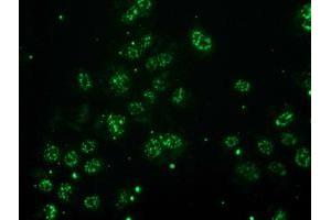 Anti-MGLL mouse monoclonal antibody (ABIN2454561) immunofluorescent staining of COS7 cells transiently transfected by pCMV6-ENTRY MGLL (RC218358). (MGLL anticorps)