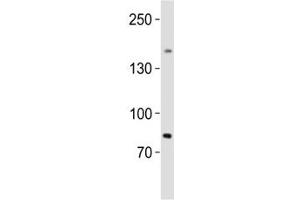 Western blot analysis of lysate from human testis tissue lysate using SALL4 antibody diluted at 1:1000. (SALL4 anticorps  (AA 1035-1069))