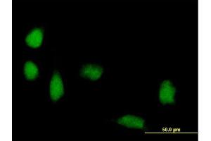 Immunofluorescence of purified MaxPab antibody to FOXP3 on HeLa cell. (FOXP3 anticorps  (AA 1-431))