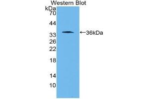 Detection of Recombinant WNT10B, Human using Polyclonal Antibody to Wingless Type MMTV Integration Site Family, Member 10B (WNT10B)
