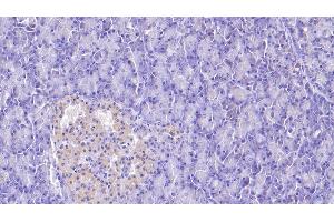 Detection of APOH in Human Pancreas Tissue using Monoclonal Antibody to Apolipoprotein H (APOH)