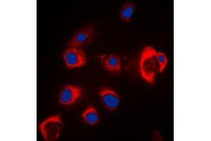 Immunofluorescent analysis of ZIP7 staining in MCF7 cells.