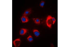 Immunofluorescent analysis of ZIP7 staining in MCF7 cells. (SLC39A7 anticorps  (Center))