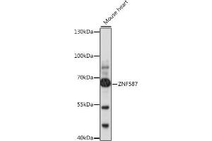 Western blot analysis of extracts of mouse heart, using ZNF587 antibody (ABIN7271507) at 1:1000 dilution. (ZNF587 anticorps  (AA 120-240))