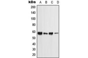 Western blot analysis of PIGW expression in MCF7 (A), NTERA2 (B), Raw264. (PIGW anticorps  (C-Term))