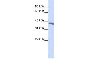 WB Suggested Anti-EDA Antibody Titration:  0. (Ectodysplasin A anticorps  (Middle Region))