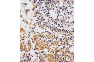 (ABIN652075 and ABIN2840539) staining CUX1 in human lymph node tissue sections by Immunohistochemistry (IHC-P - paraformaldehyde-fixed, paraffin-embedded sections). (CUX1 anticorps  (AA 1347-1374))