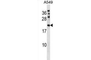 Western Blotting (WB) image for anti-M-Phase phosphoprotein 6 (MPHOSPH6) antibody (ABIN2998749)