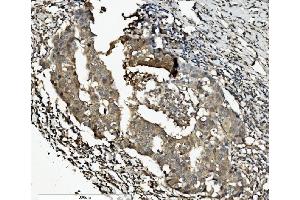 IHC analysis of Caspase-7/CASP7 using anti-Caspase-7/CASP7 antibody (ABIN7600823). (Caspase 7 anticorps  (AA 24-303))