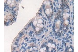 Detection of GR in Mouse Small intestine Tissue using Polyclonal Antibody to Glutathione Reductase (GR)