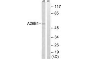 Western blot analysis of extracts from Jurkat cells, using A26B1 Antibody.