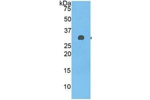 WB of Protein Standard: different control antibodies against Highly purified E.
