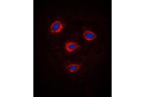 Immunofluorescent analysis of Frizzled 8 staining in Jurkat cells. (FZD8 anticorps  (C-Term))