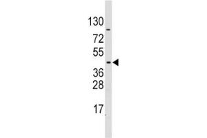 Western blot analysis of PDK4 antibody and CEM lysate