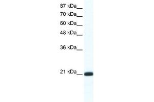 WB Suggested Anti-RAXL1 Antibody Titration:  1.
