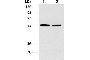 Western blot analysis of Mouse brain tissue NIH/3T3 cell lysates using CORO2B Polyclonal Antibody at dilution of 1:1000 (CORO2B anticorps)