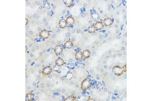 Immunohistochemistry of paraffin-embedded mouse kidney using NOD1 antibody (ABIN3021837, ABIN3021838, ABIN3021839 and ABIN6216095) at dilution of 1:100 (40x lens).