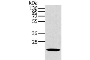 Western Blot analysis of Human liver cancer tissue using OTUB2 Polyclonal Antibody at dilution of 1:800 (OTUB2 anticorps)