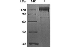 Western Blotting (WB) image for Integrin beta 1 (ITGB1) protein (His tag) (ABIN7319758) (ITGB1 Protein (His tag))