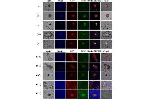 On-chip cholangiocarcinoma (CCA) cell capture and consequent immunofluorescence (IF) staining with CCA-specific biomarkers (CK7 and CK17).