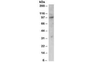 Western blot testing of Jurkat lysate with PRAM1 antibody at 2ug/ml. (PRAM1 anticorps)