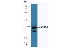 Mouse heart lysates probed with Rabbit Anti-ANKRD1 Polyclonal Antibod, Unconjugated  at 1:5000 90min in 37˚C. (ANKRD1 anticorps  (AA 185-319))