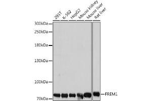 Western blot analysis of extracts of various cell lines, using FREM1 antibody (ABIN7267259) at 1:1000 dilution. (FREM1 anticorps  (AA 1880-2179))