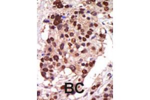 Immunohistochemistry (IHC) image for anti-Protein Kinase D3 (PRKD3) antibody (ABIN3002937) (PRKD3 anticorps)